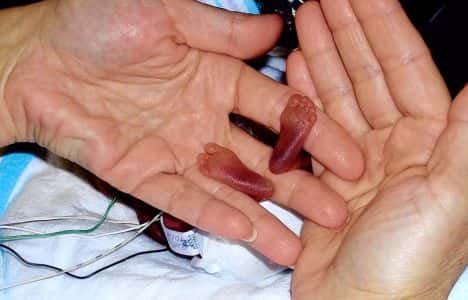 Feet Amillia Taylor - pregnancy Facts