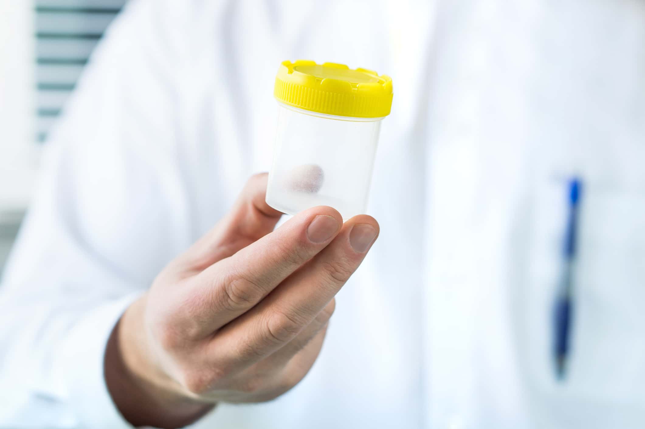 Doctor holding urine sample cup.