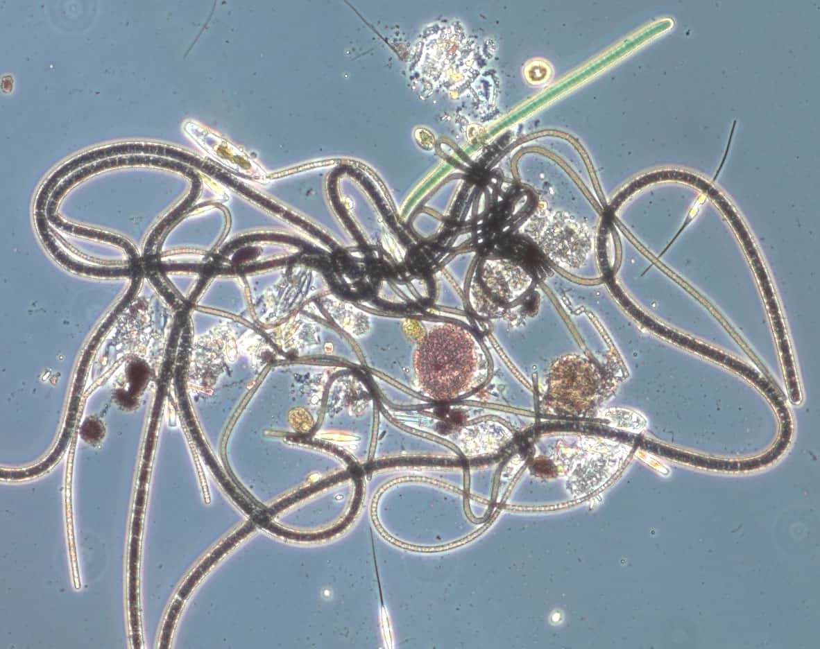Parasites Rash Ocean 24 Terrifying Ocean Facts That Will Make You Re-think Ever Swimming Again