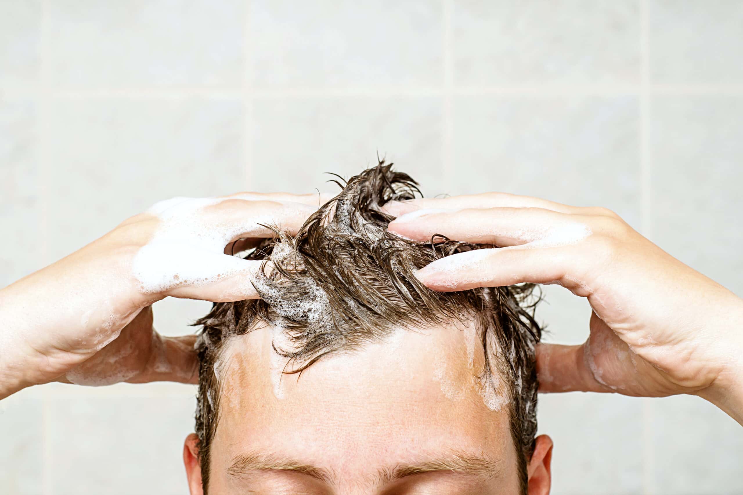 Preventing Hair Loss Review