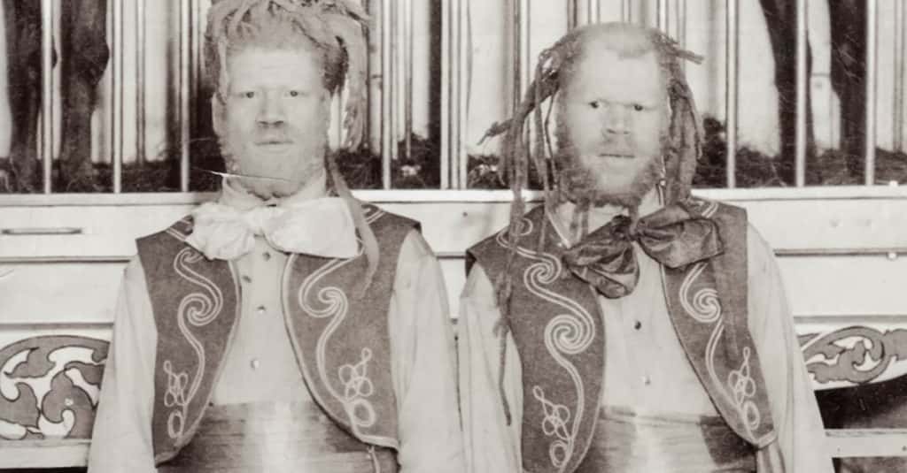 Twisted Facts About the Muse Brothers, The Heartbreaking Circus Act